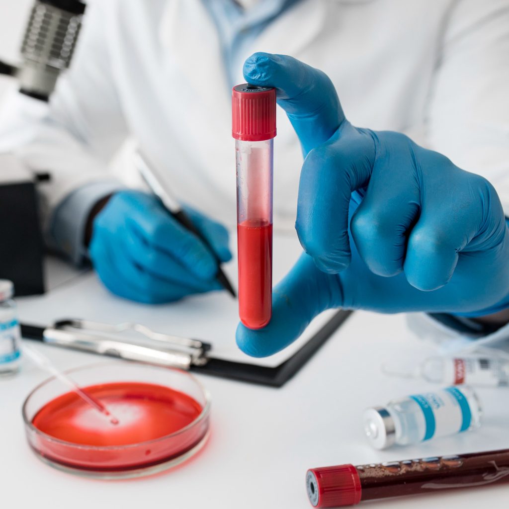 Coagulation Studies