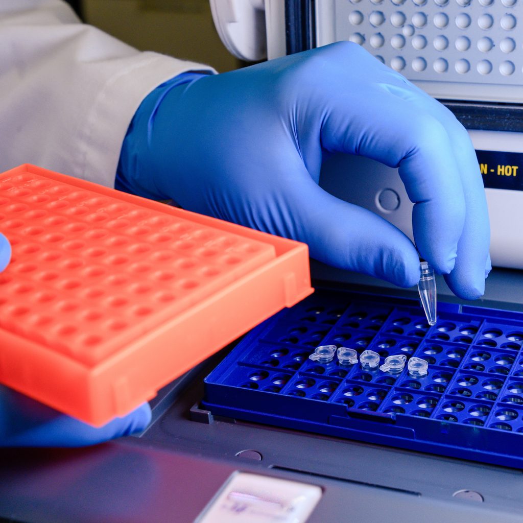 Molecular Diagnostics (PCR)