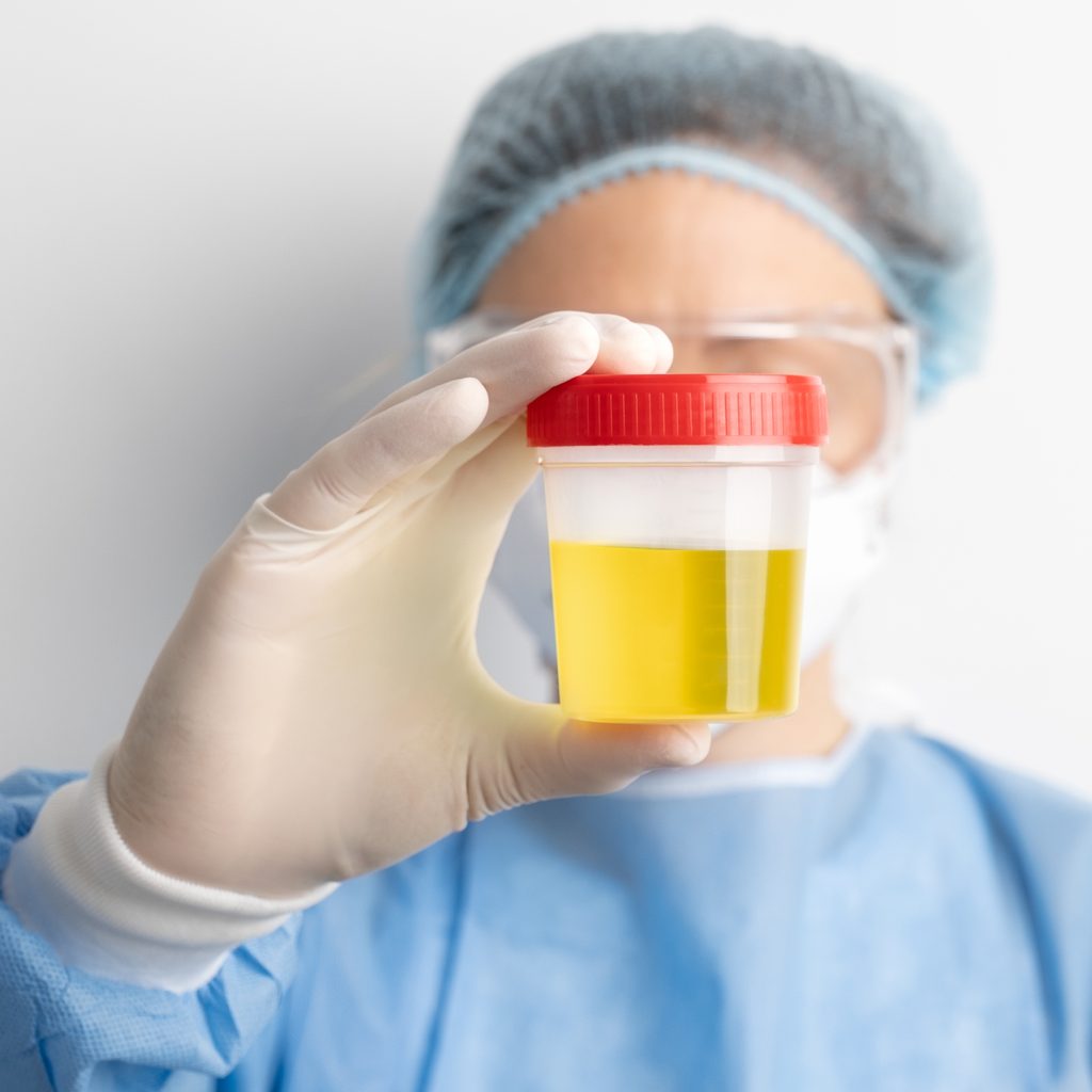 Urine & Stool Analysis